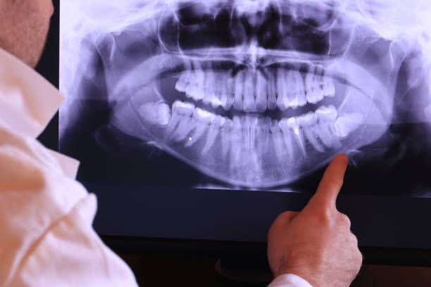 Best Orthodontic Emergency Dentist in Warren, IL